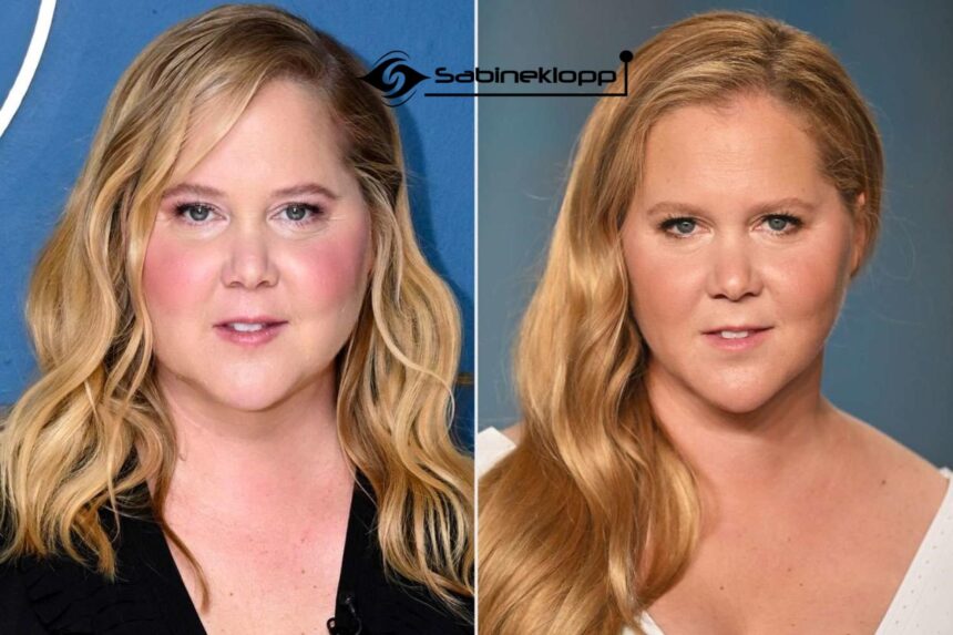 Amy Schumer